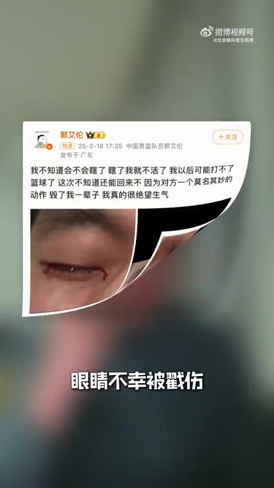 眼科专家谈郭艾伦：结膜受伤经处理大概率恢复得不错 不要太忧心